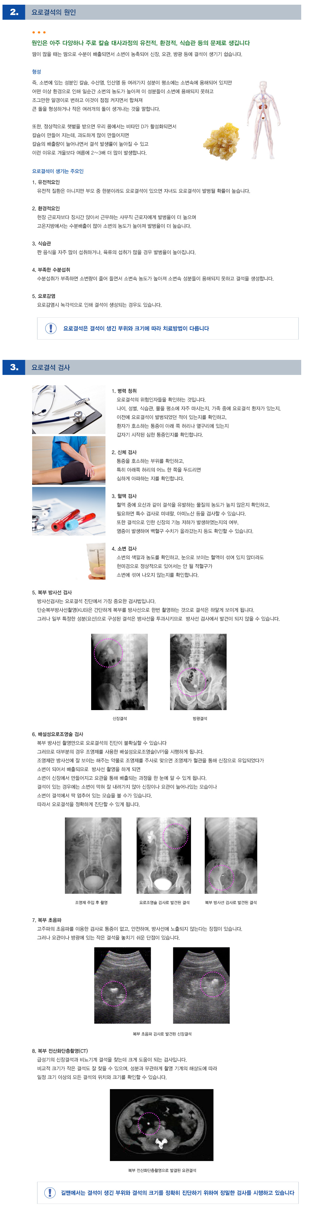 요로결석